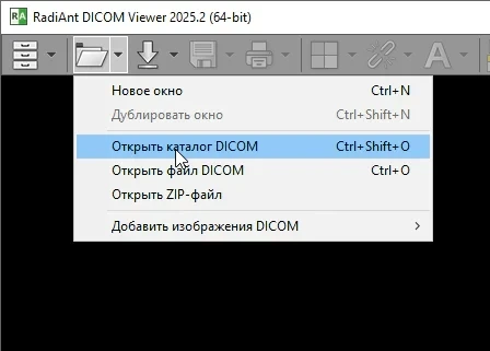RadiAnt DICOM Viewer
